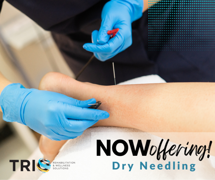 Dry Needling Therapy – What is it & Who Needs It? - Trio Rehabilitation ...